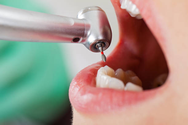 Best Emergency Dental Care for Broken or Chipped Teeth in Eagle Pass, TX